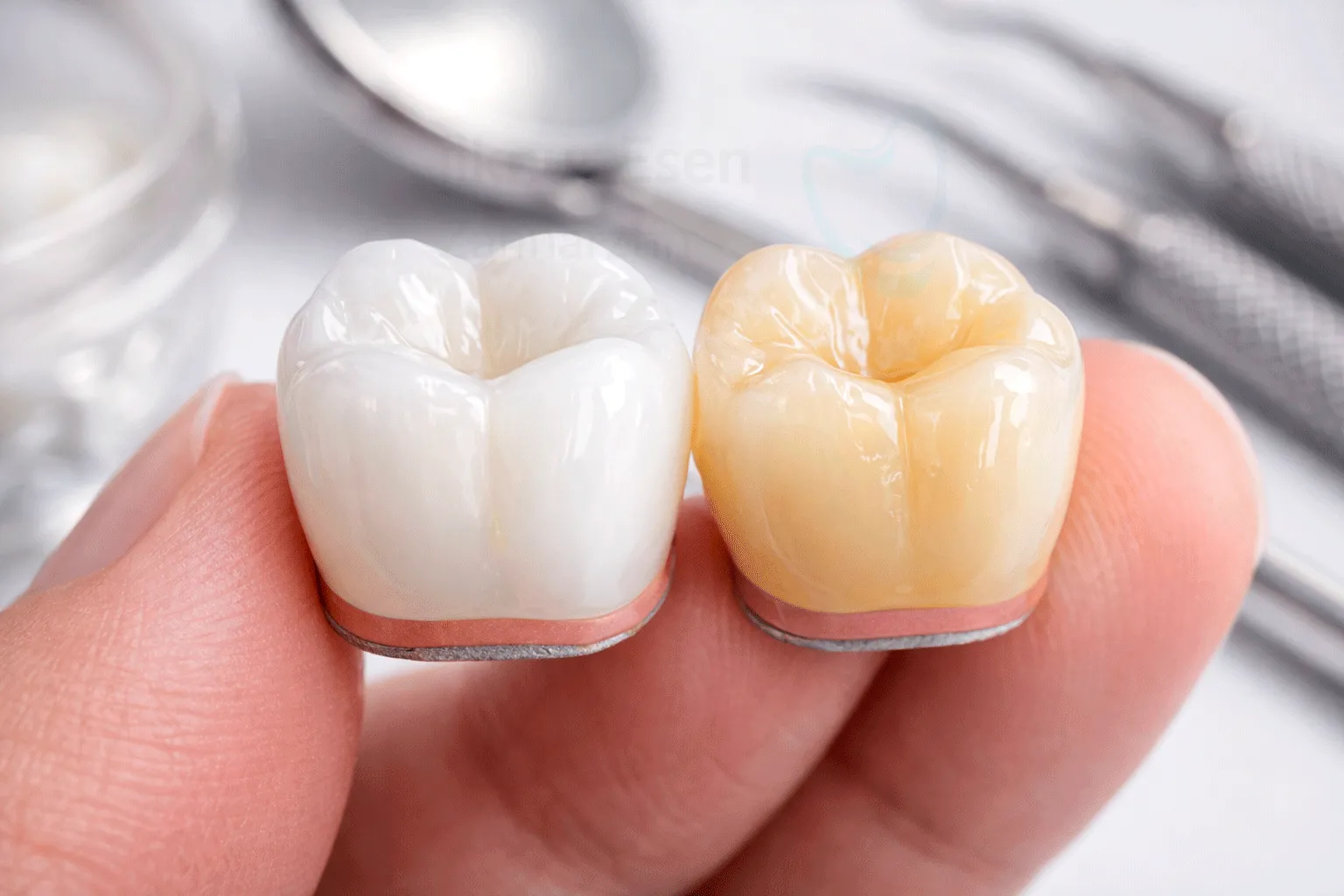 Konservative Zahnbehandlung